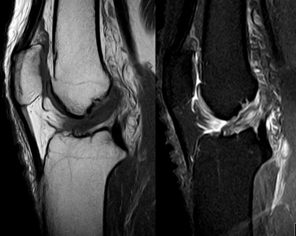 an MRI test of a knee