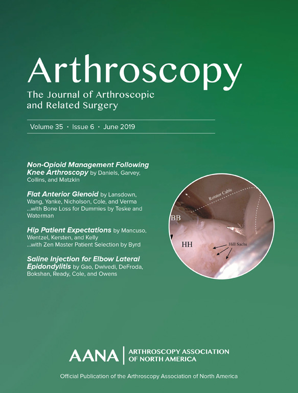 Arthoscopy Journal